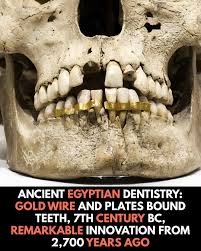 Ancient Egyptian dental treatment