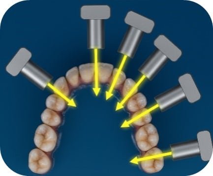 Beam through contacts