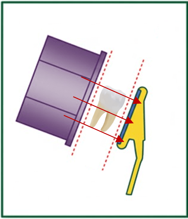Paralleling step 1 (image 1)