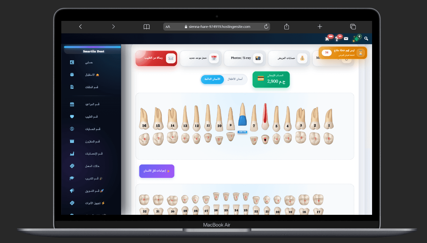 Smartii Dent على اللابتوب والكمبيوتر